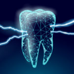 歯に起こる様々なトラブル