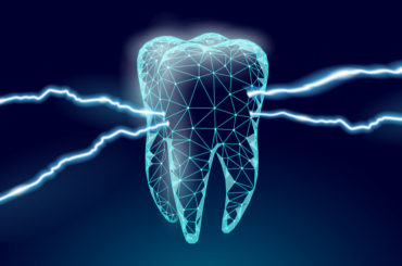 歯に起こる様々なトラブル