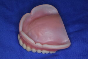 上顎の総義歯の内面が生体シリコーンでつくられている
