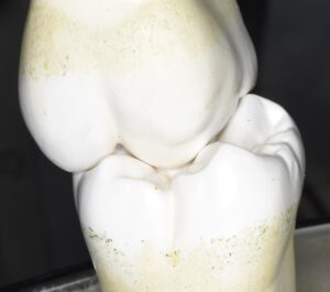第1大臼歯のクラスⅠ咬合状態口蓋側面観